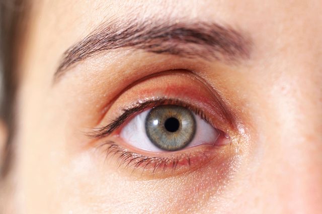signs disease face yellow spots