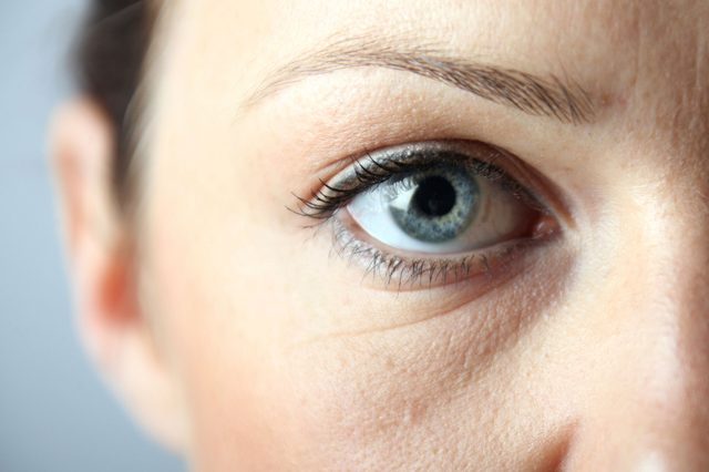 signs disease face puffy eyes
