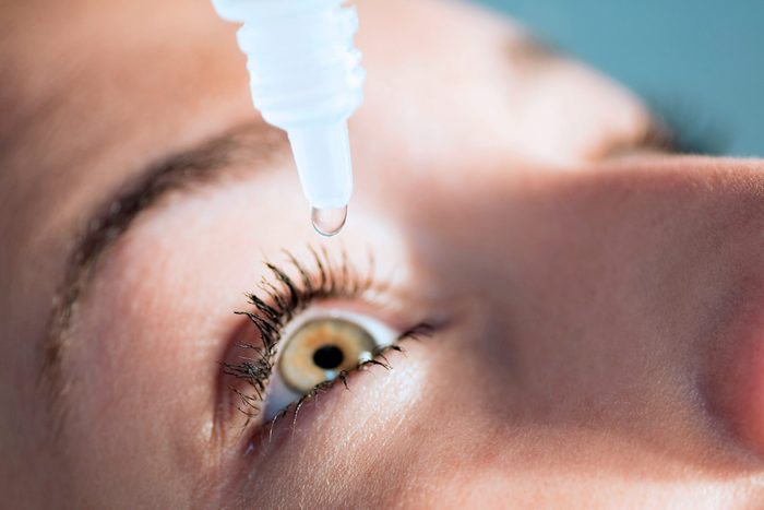 eye drop bottle with drop going into woman's eye