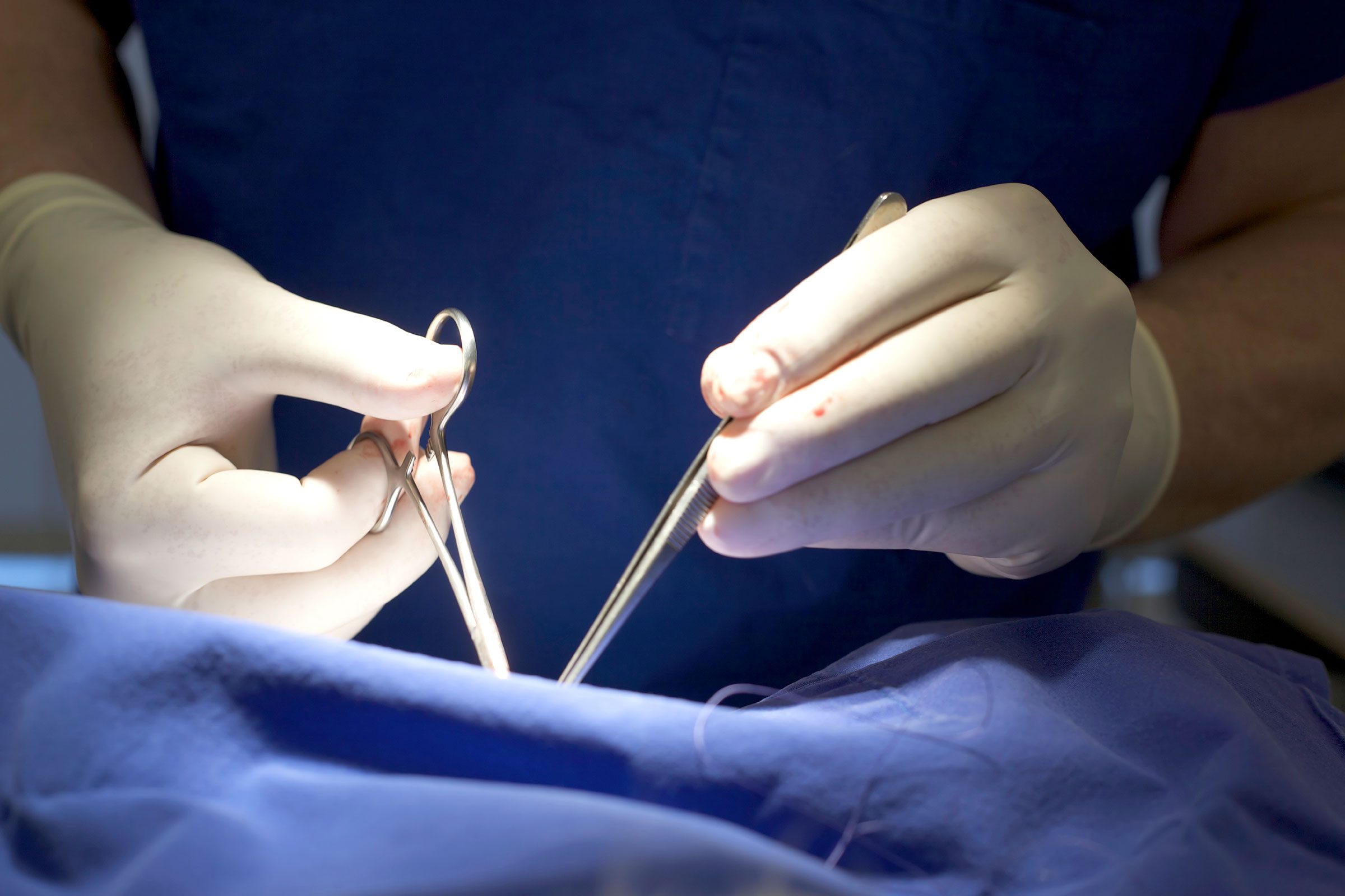 surgeon's' gloved hands and instruments