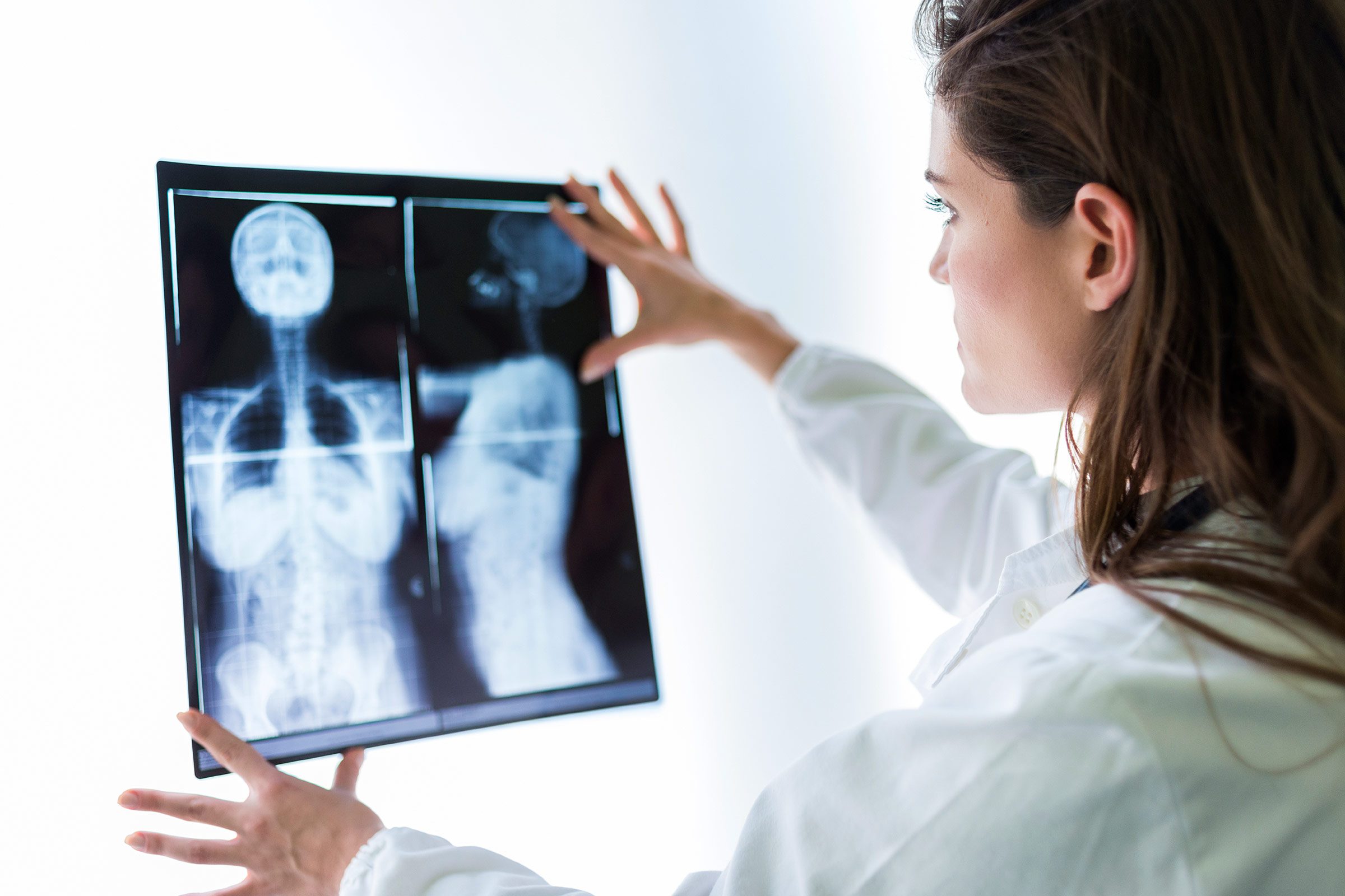 woman doctor looking at x-ray