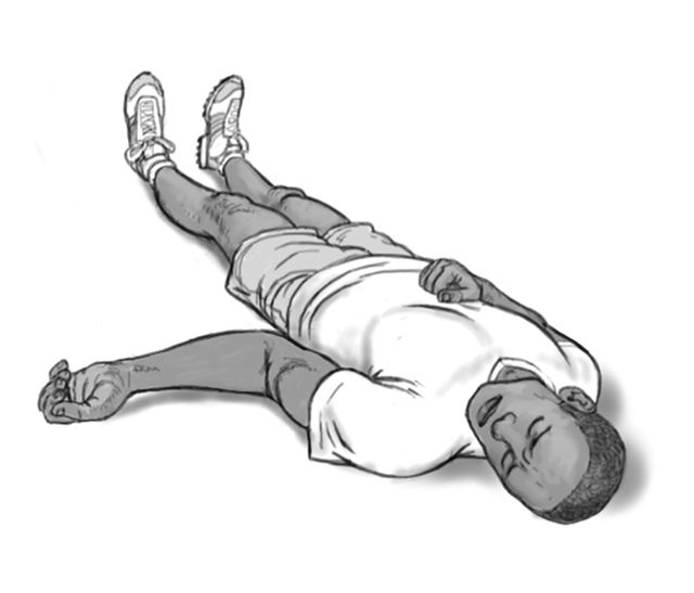 dislocated shoulder arm rotation 1