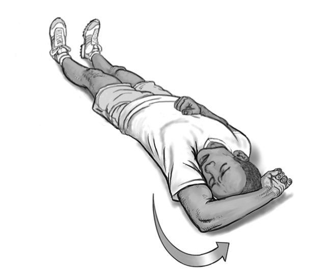 dislocated shoulder arm rotation 3