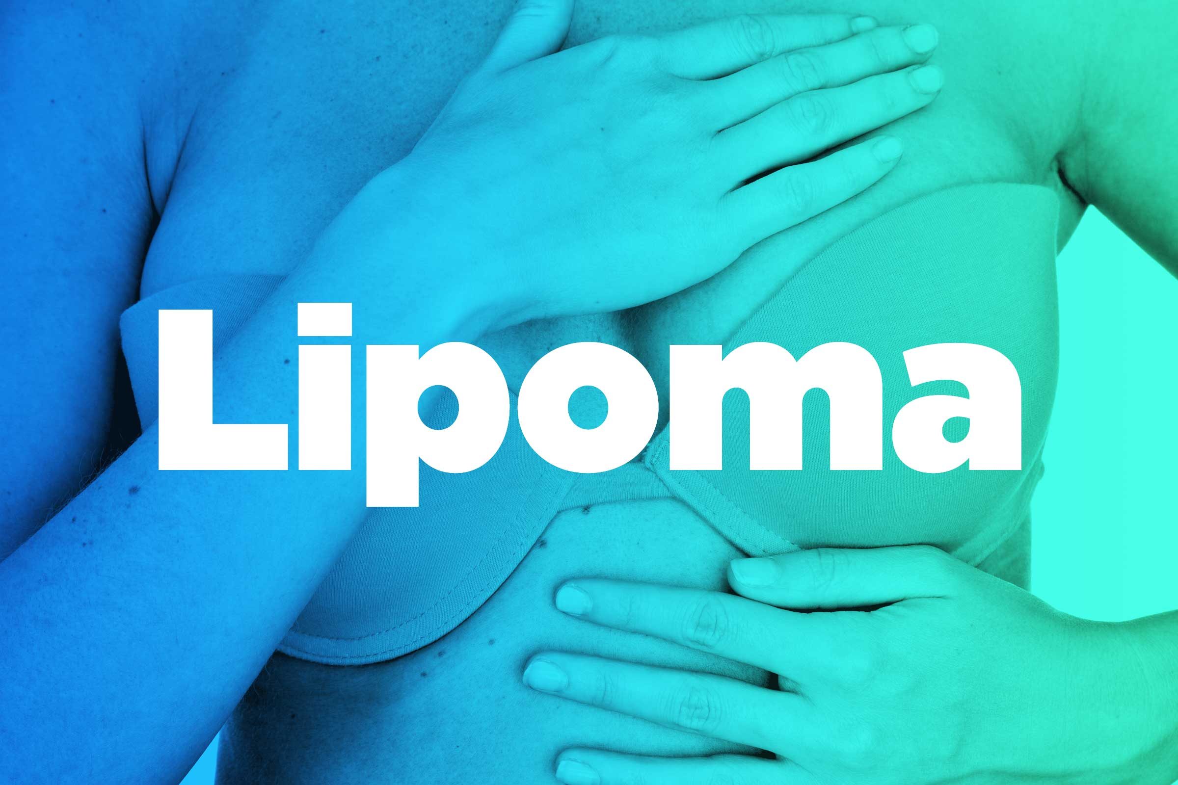 lipoma