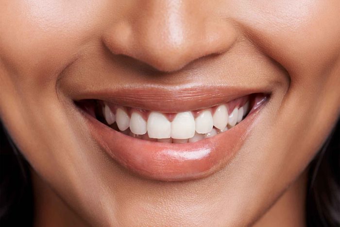close-up of woman's smile
