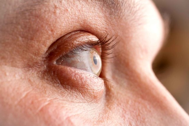 blurry vision, eye closeup