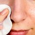 8 Home Remedies to Make Blackheads Vanish