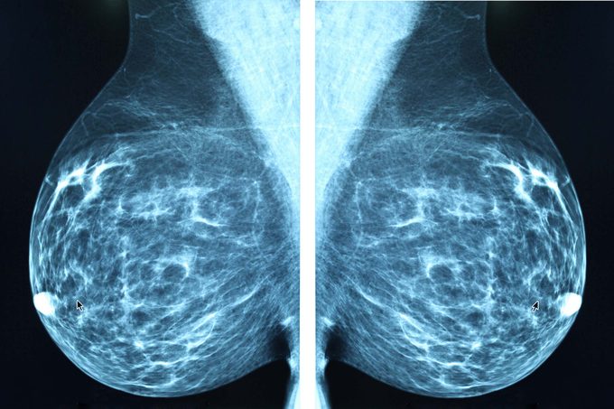 02-did-abnormal-mammogram-questions-BluePlanetEarth