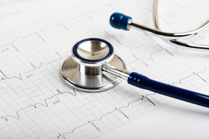 stethoscope on a cardiac rhythm print out