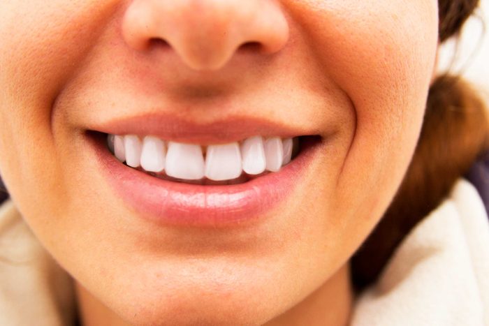 woman's smile with white teeth