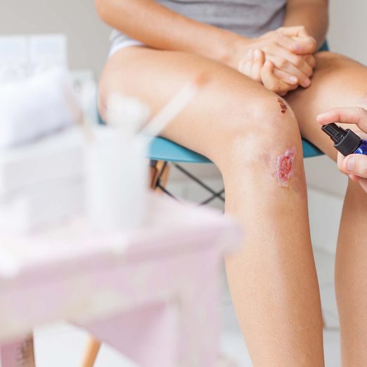 leg with infected cut on it with someone spraying it