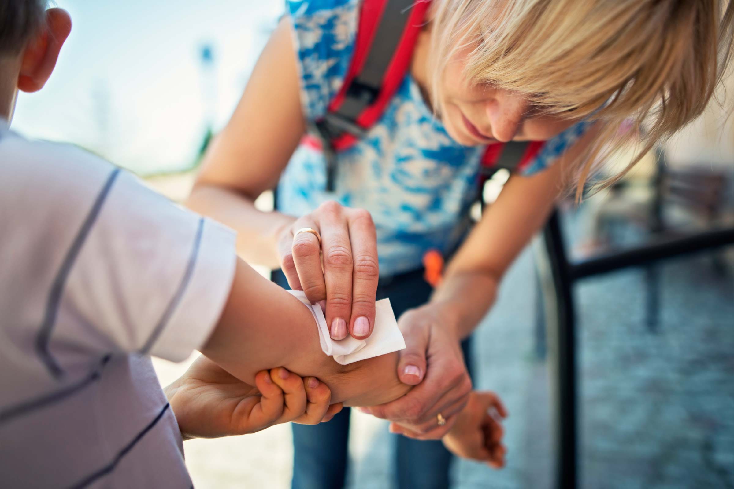 Mother treating child's infected cut