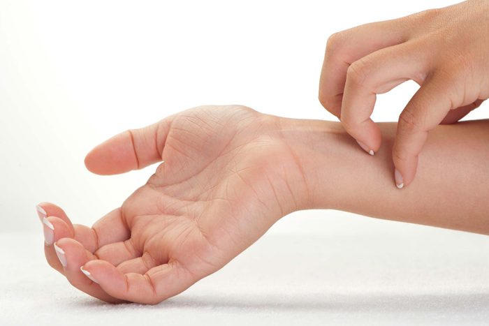 woman's hand itching her own wrist