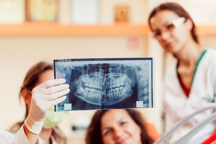 female medical staff looking at an x-ray of the jaw