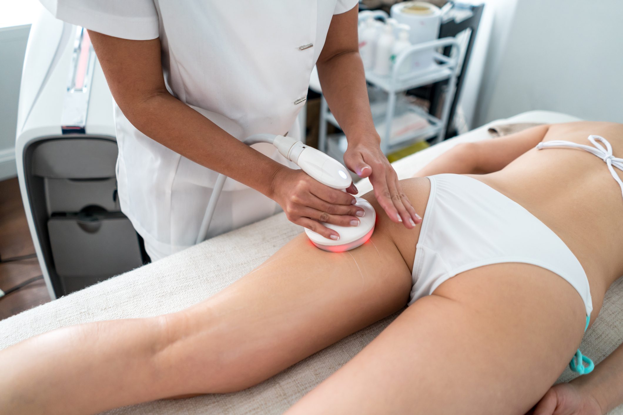 cellulite laser treatment