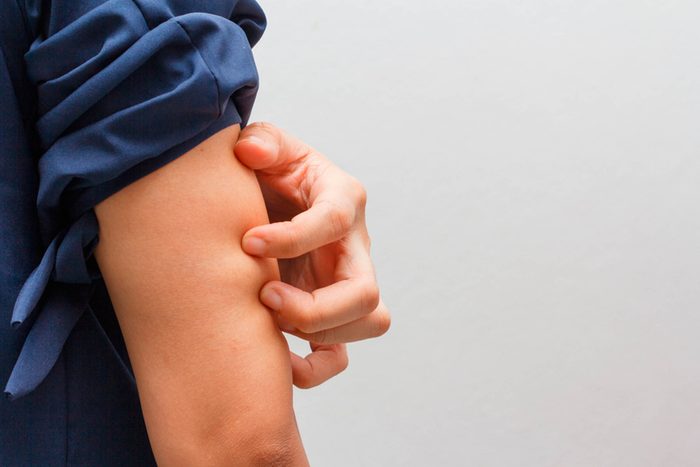 person scratching their upper arm