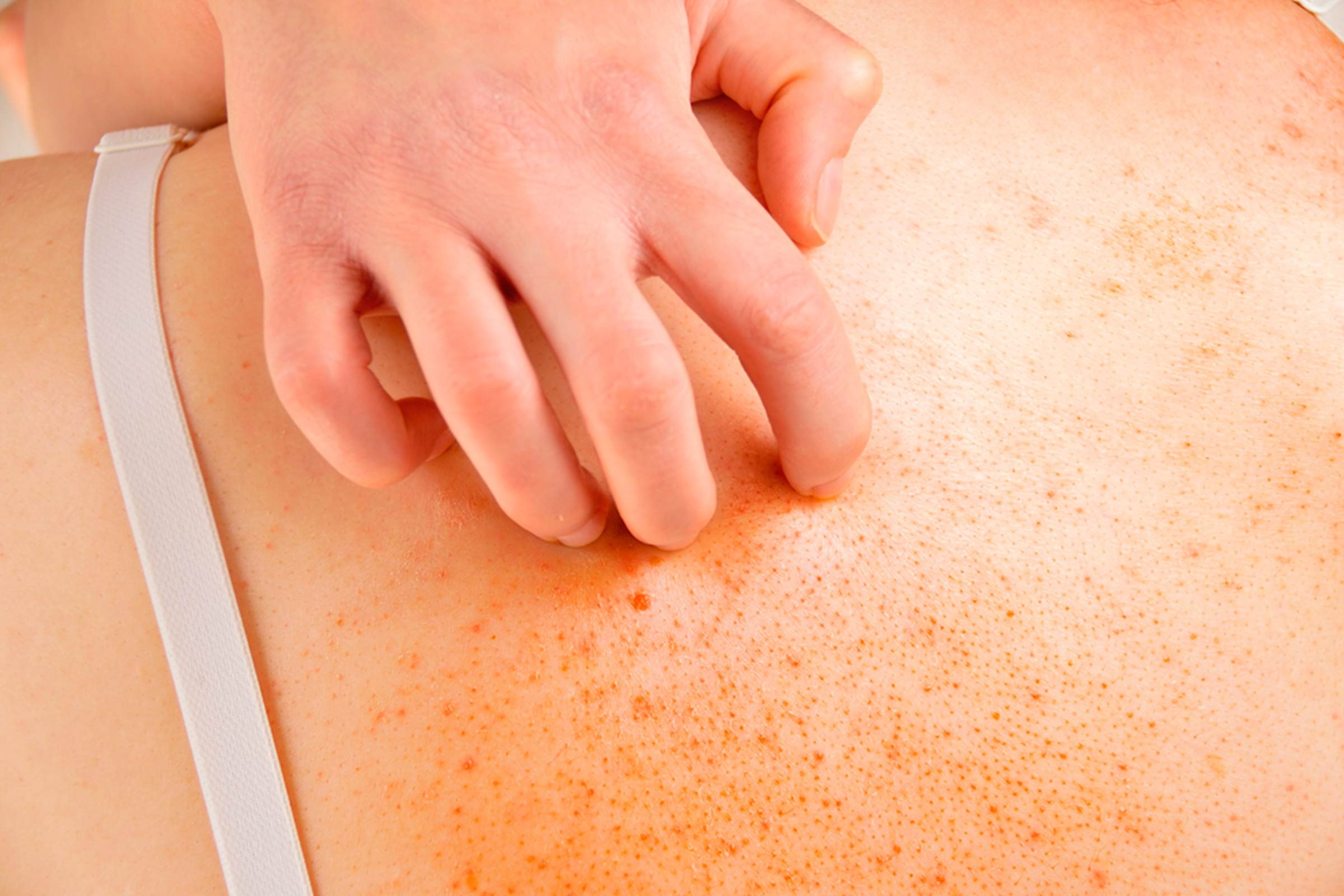 hand scratching skin