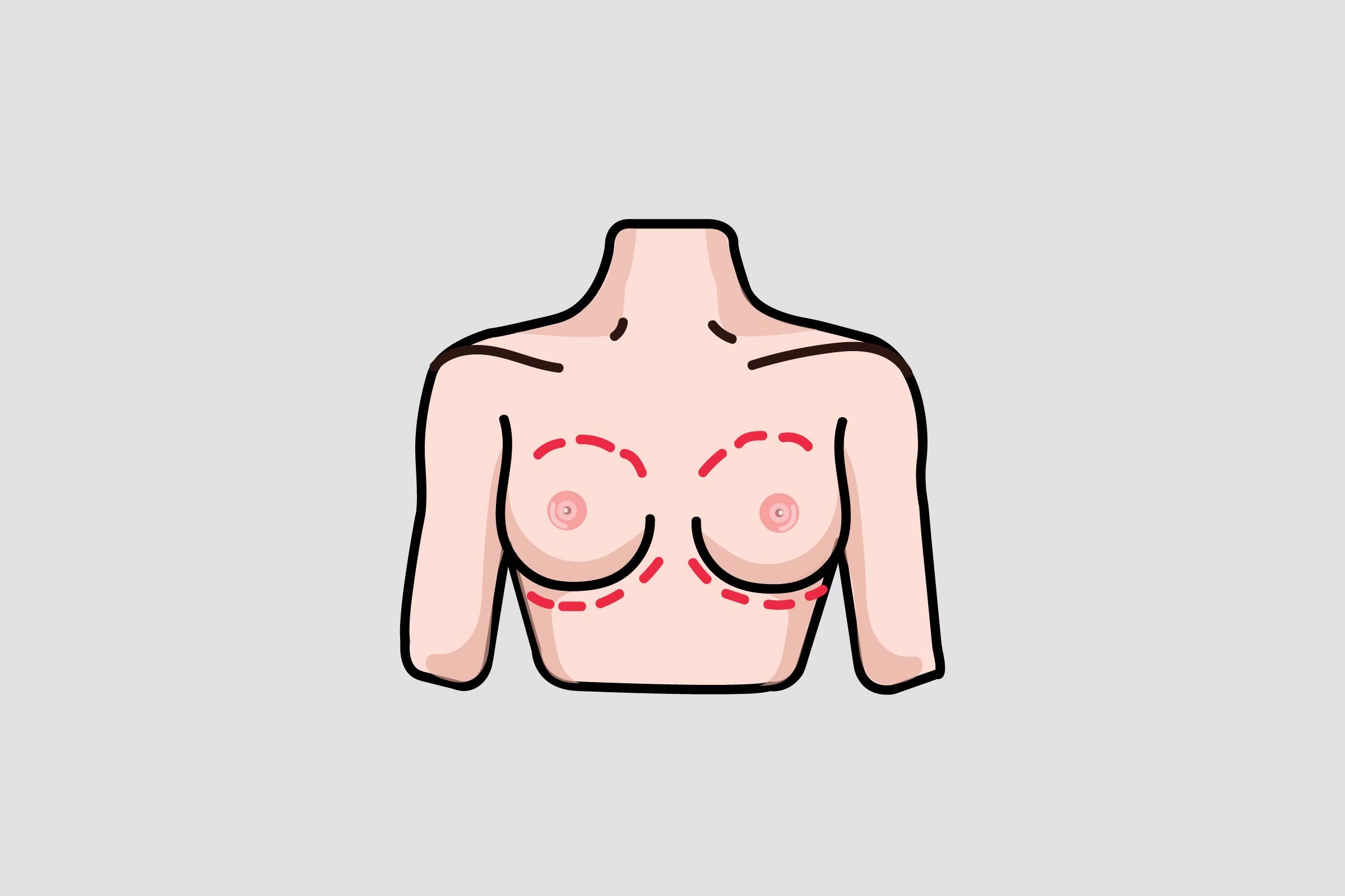 illustration of breasts