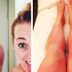 These Hilarious Sunburns Will Make You Laugh and Cringe at the Same Time