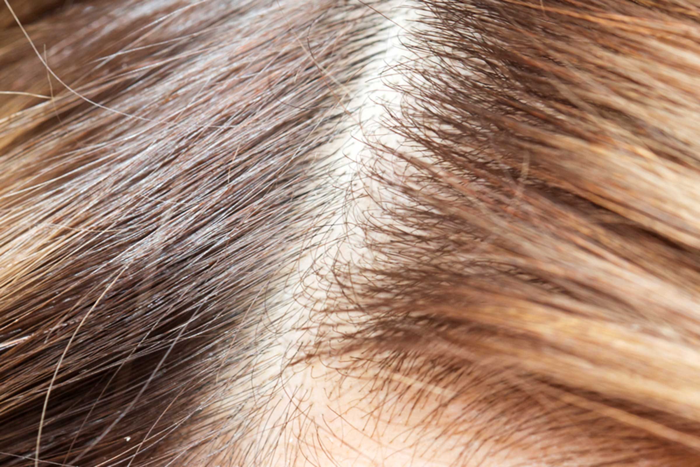 part in someone's scalp