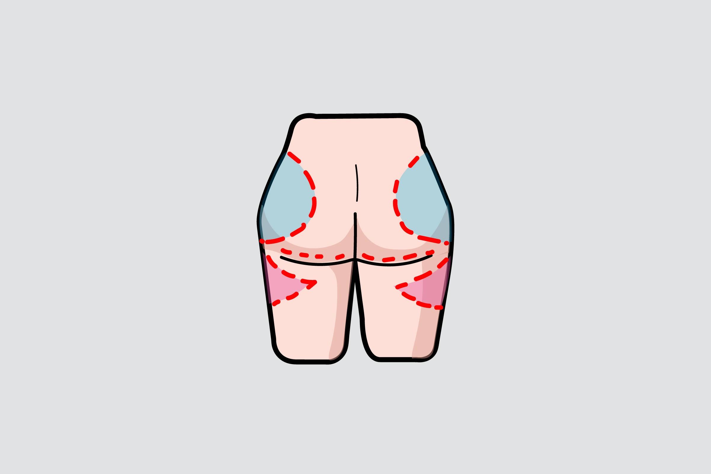 illustration of a woman's buttocks