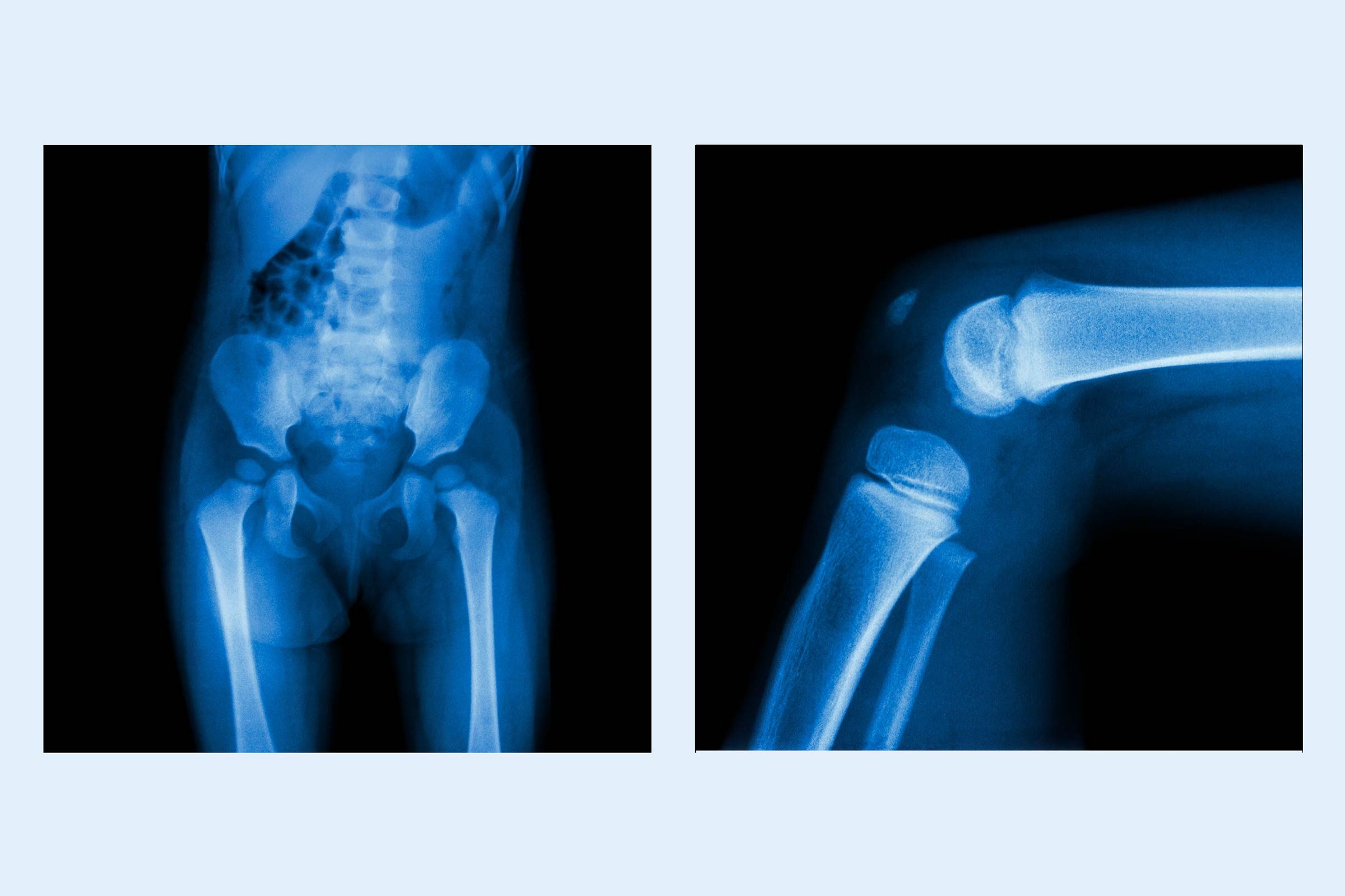 Forget-Big-Boned--Are-Your-Bones-Fat-197985785-Puwadol-Jaturawutthichai