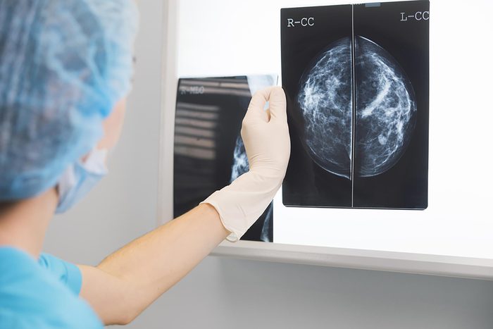 mammogram