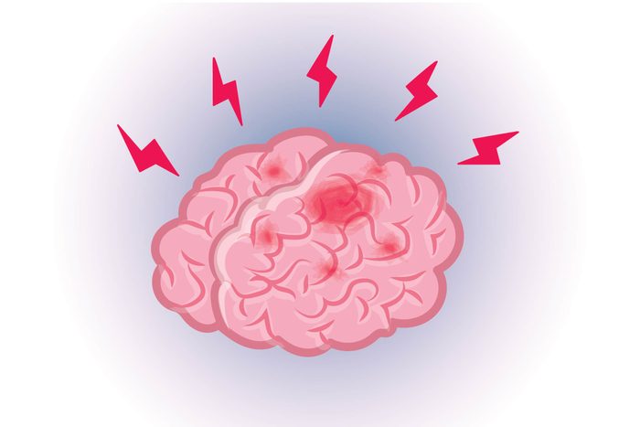 Graphic of human brain with lightning bolts all around