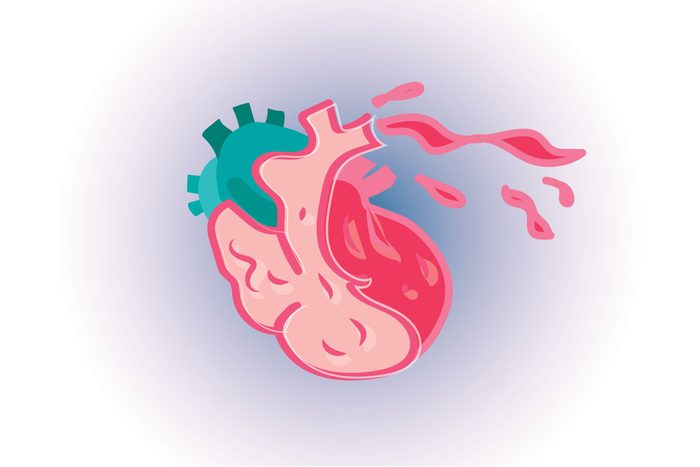 Graphic of human brain