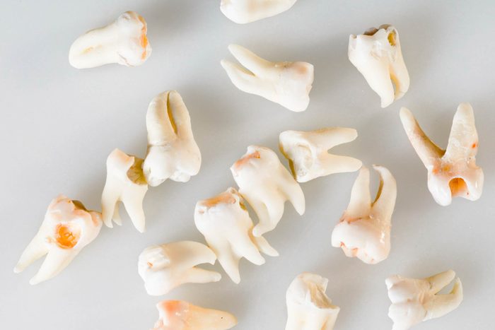 Things-Your-Dentist-Wants-You-to-Know-(But-You're-Too-Scared-to-Ask)