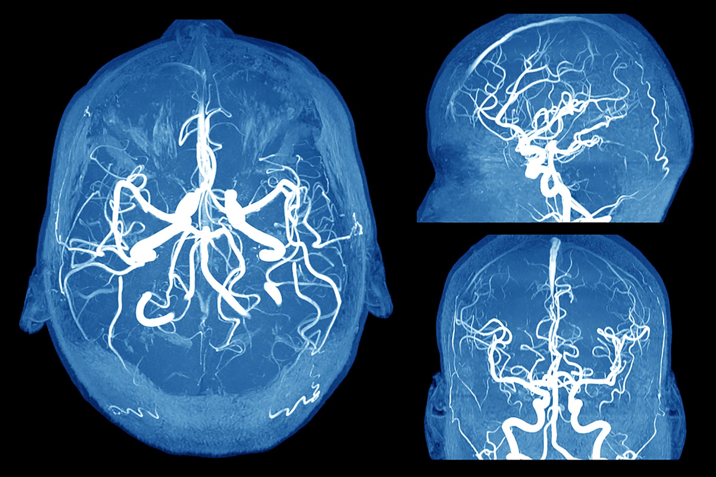 brain scans, top, side and front