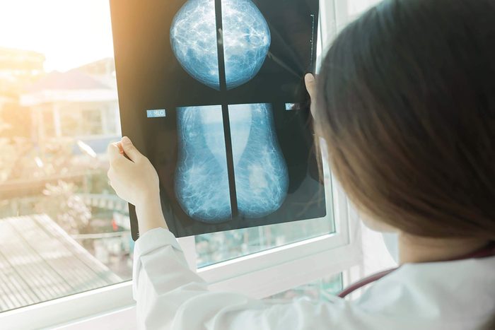 mammogram