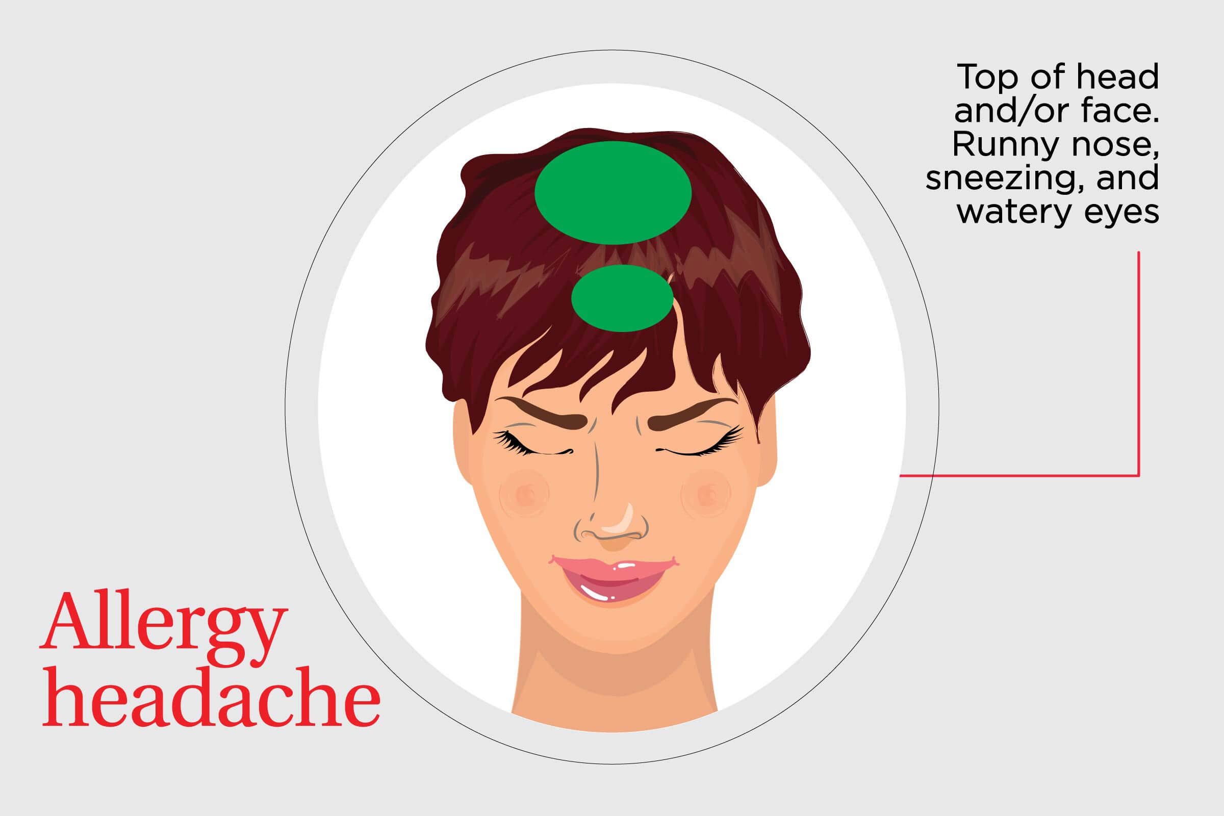 illustration of the pain associated with an allergy headache