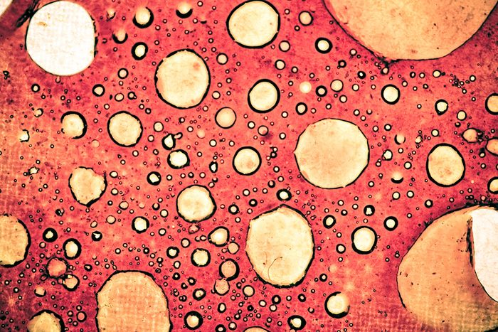 Red image of cancerous cells beneath a microscope.