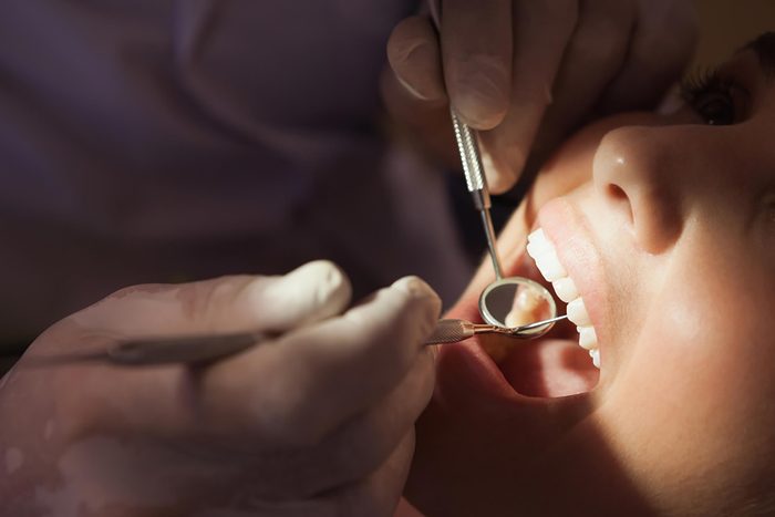 Dentist examining patient's mouth with scraper and mirror