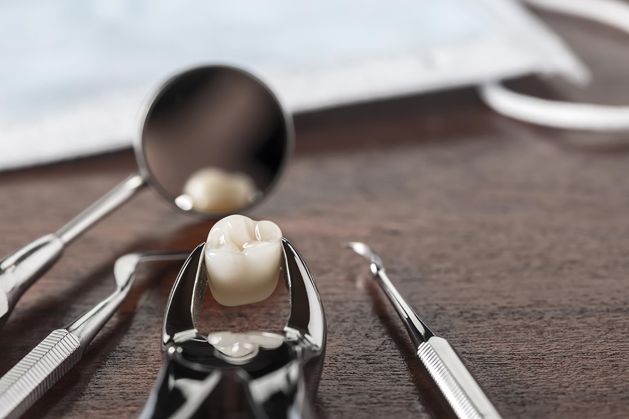dental pliers holding an extracted molar