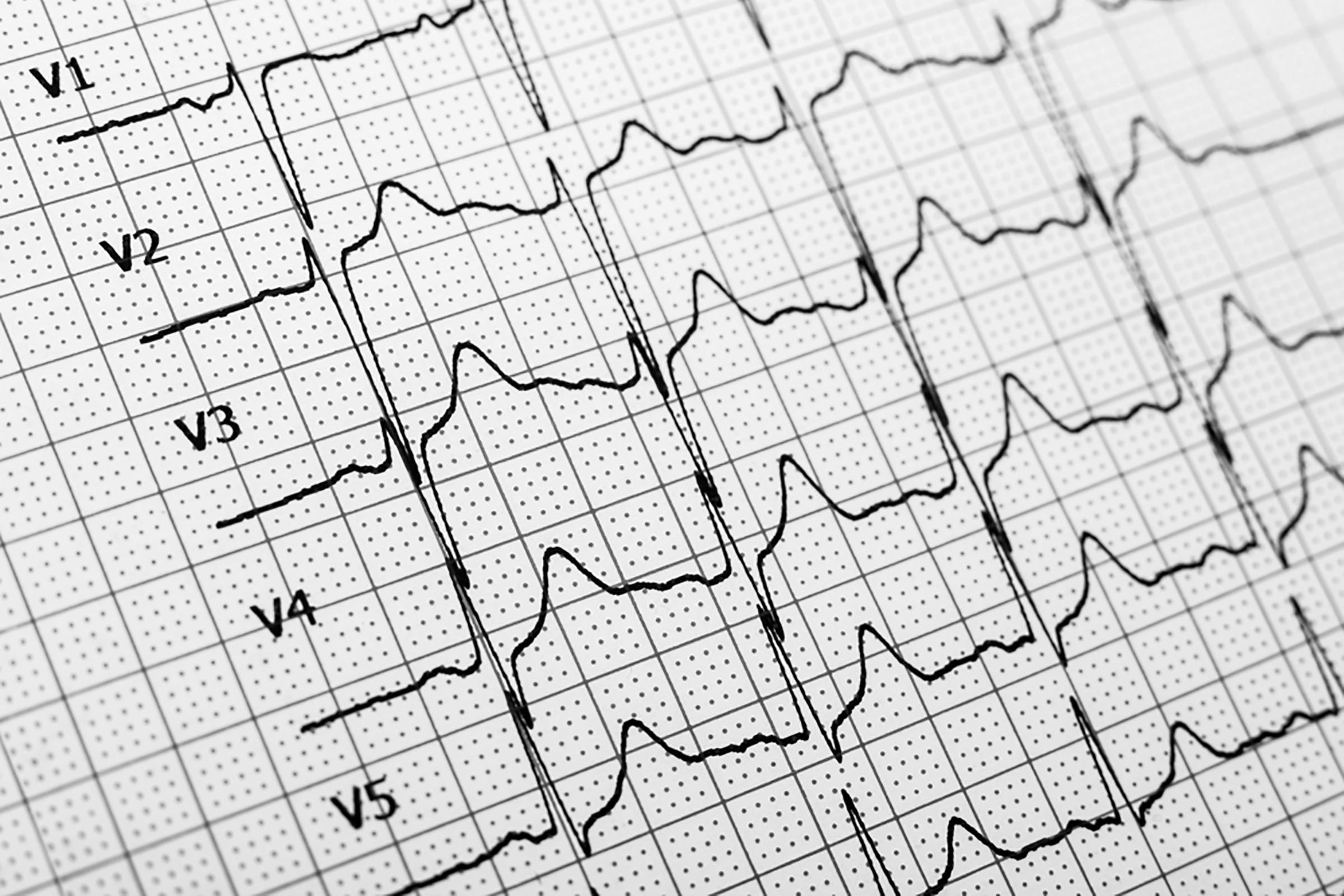 heart rate chart