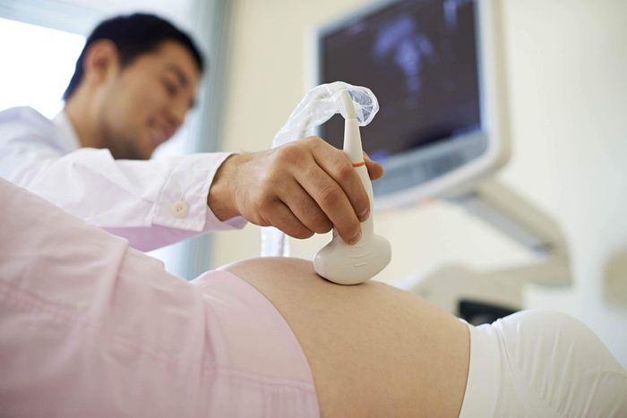 A woman having an ultrasound.