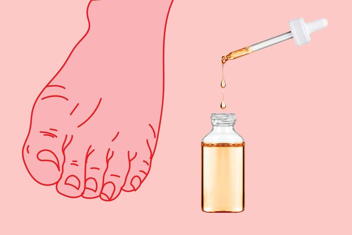 illustration of a foot with photo of dropper and bottle