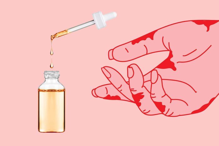 illustration of a hand with hotspots with photo of dropper and bottle