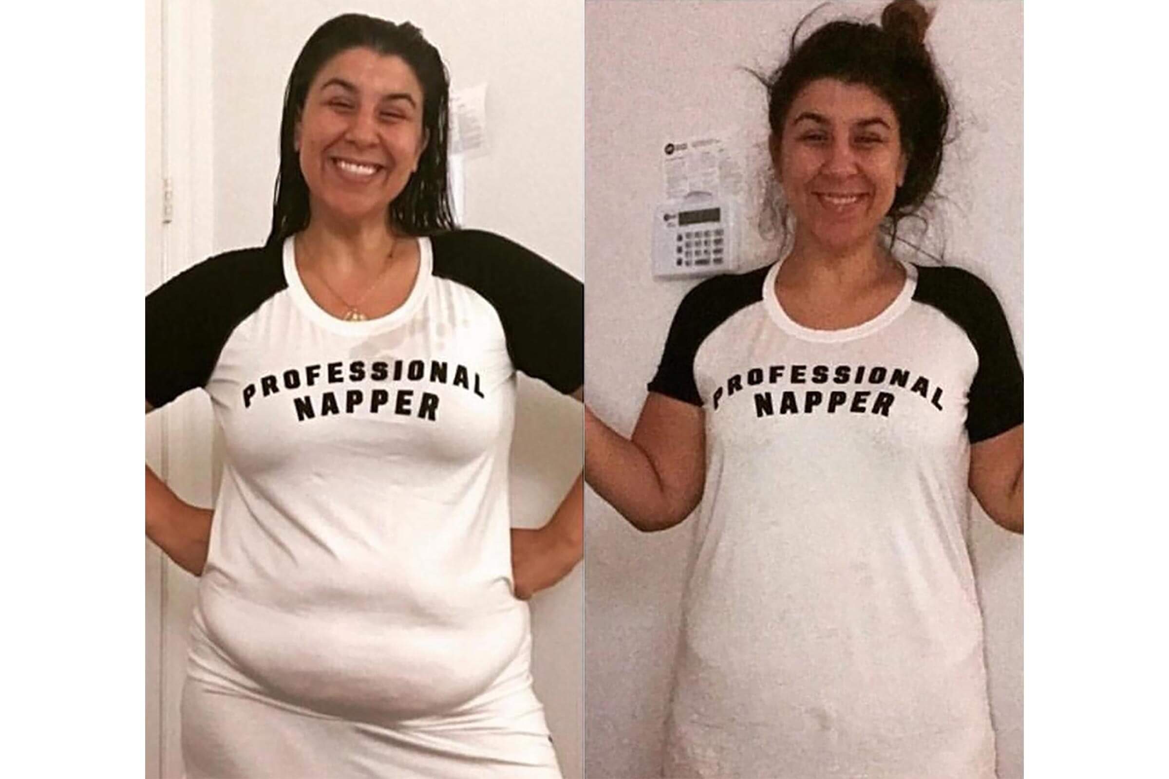 Natalie, before and after