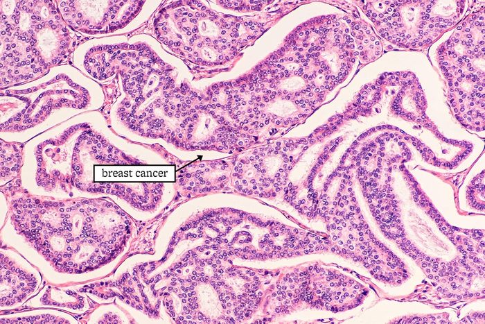 23 Groundbreaking Cancer Research That Could Save Your Life