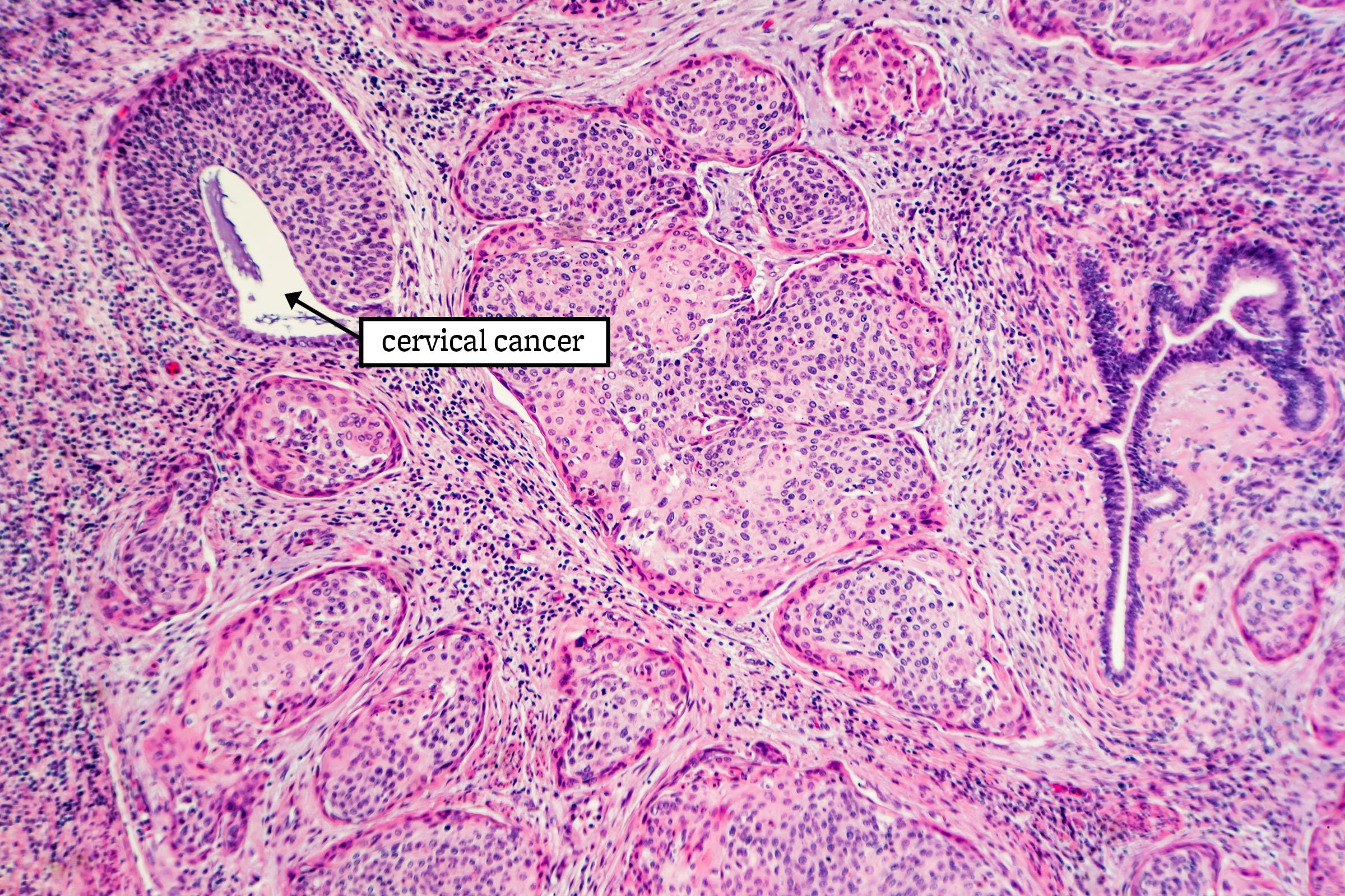 23 Groundbreaking Cancer Research That Could Save Your Life