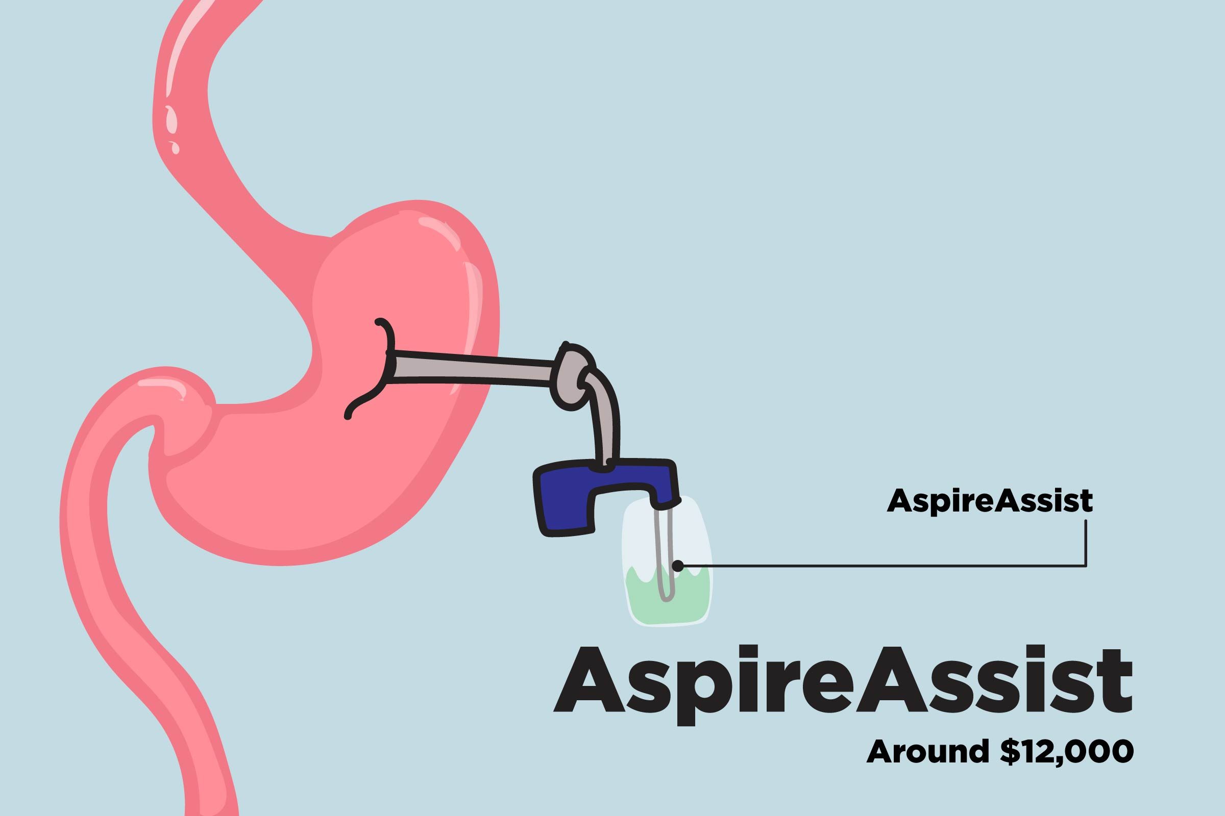 Top-Weight-Loss-Surgery-Procedures