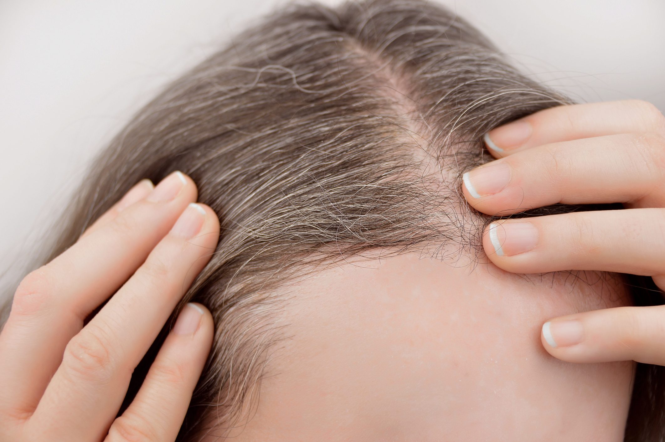 young woman with gray hairs