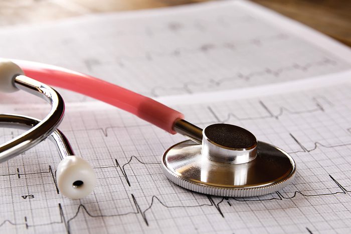 Stethoscope on ekg printout
