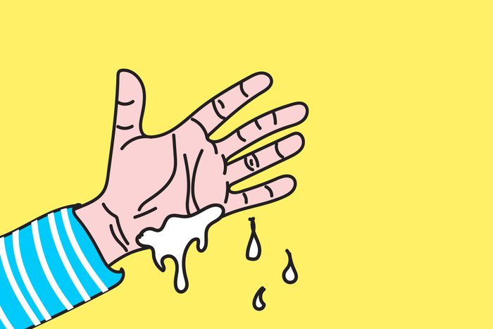 illustration of sweaty palm
