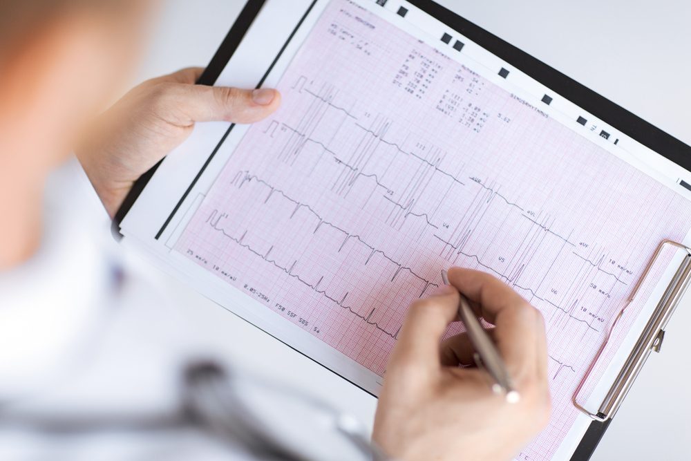 bright picture of male doctor hands with cardiogram