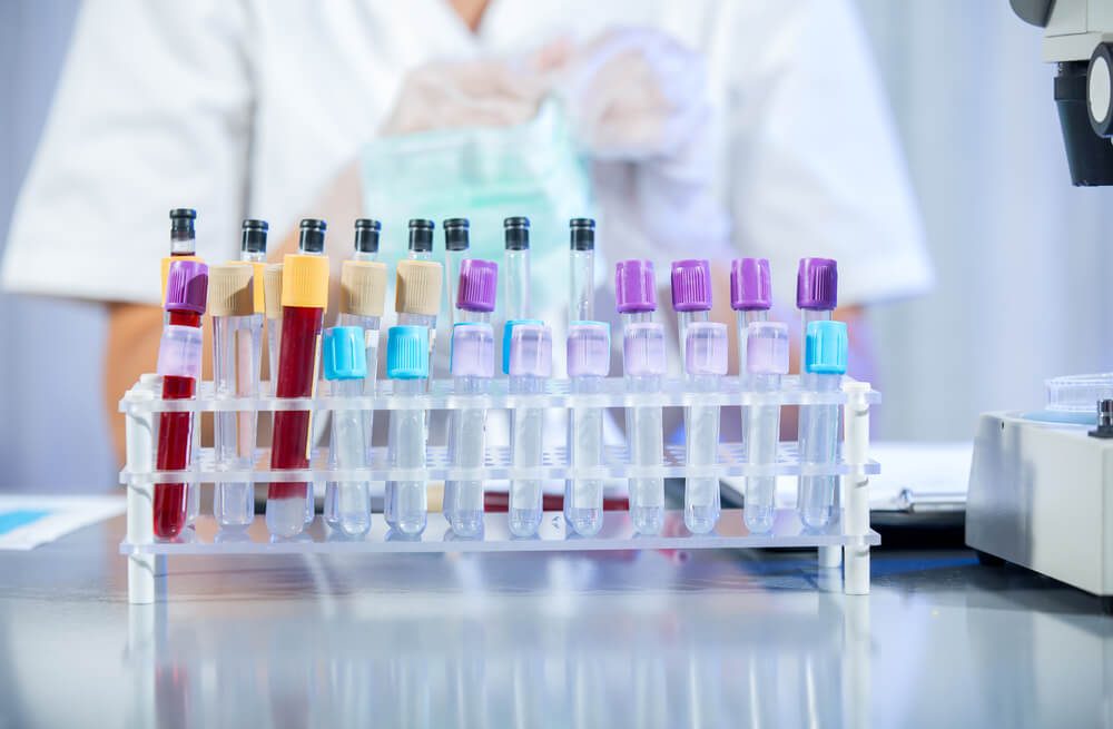 Test tubes in the laboratory - selective focus