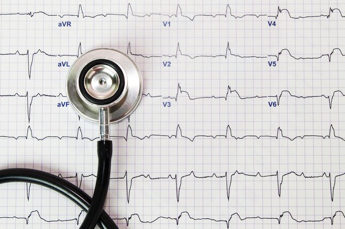 Stethoscope on the electrocardiogram (ECG) graph